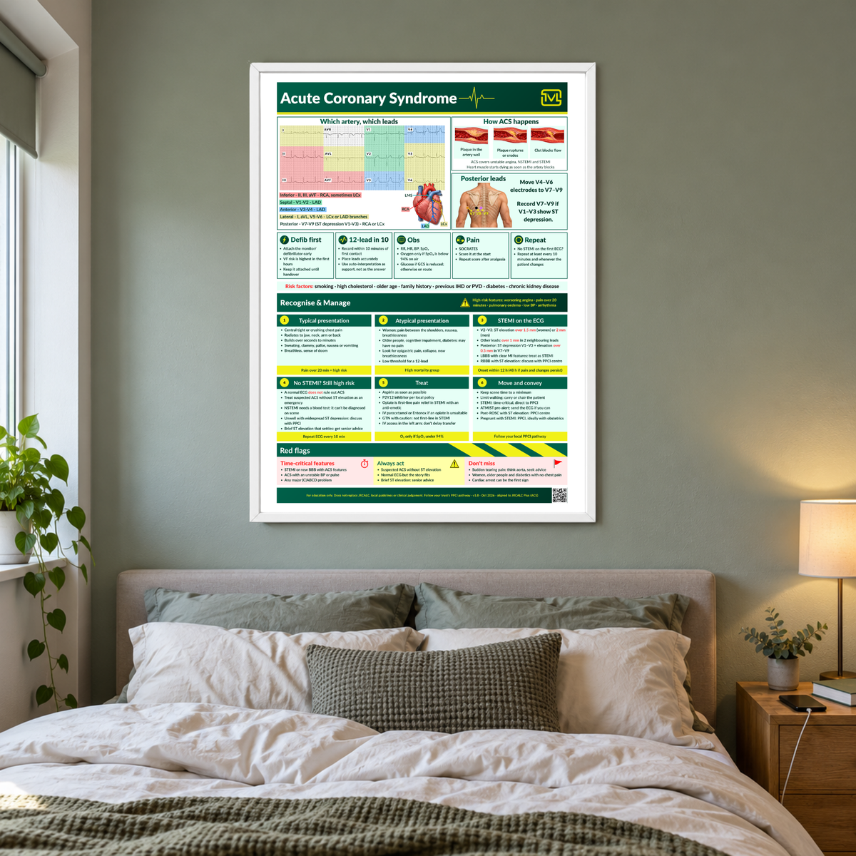 Acute Coronary Syndrome (ACS) ECG Poster