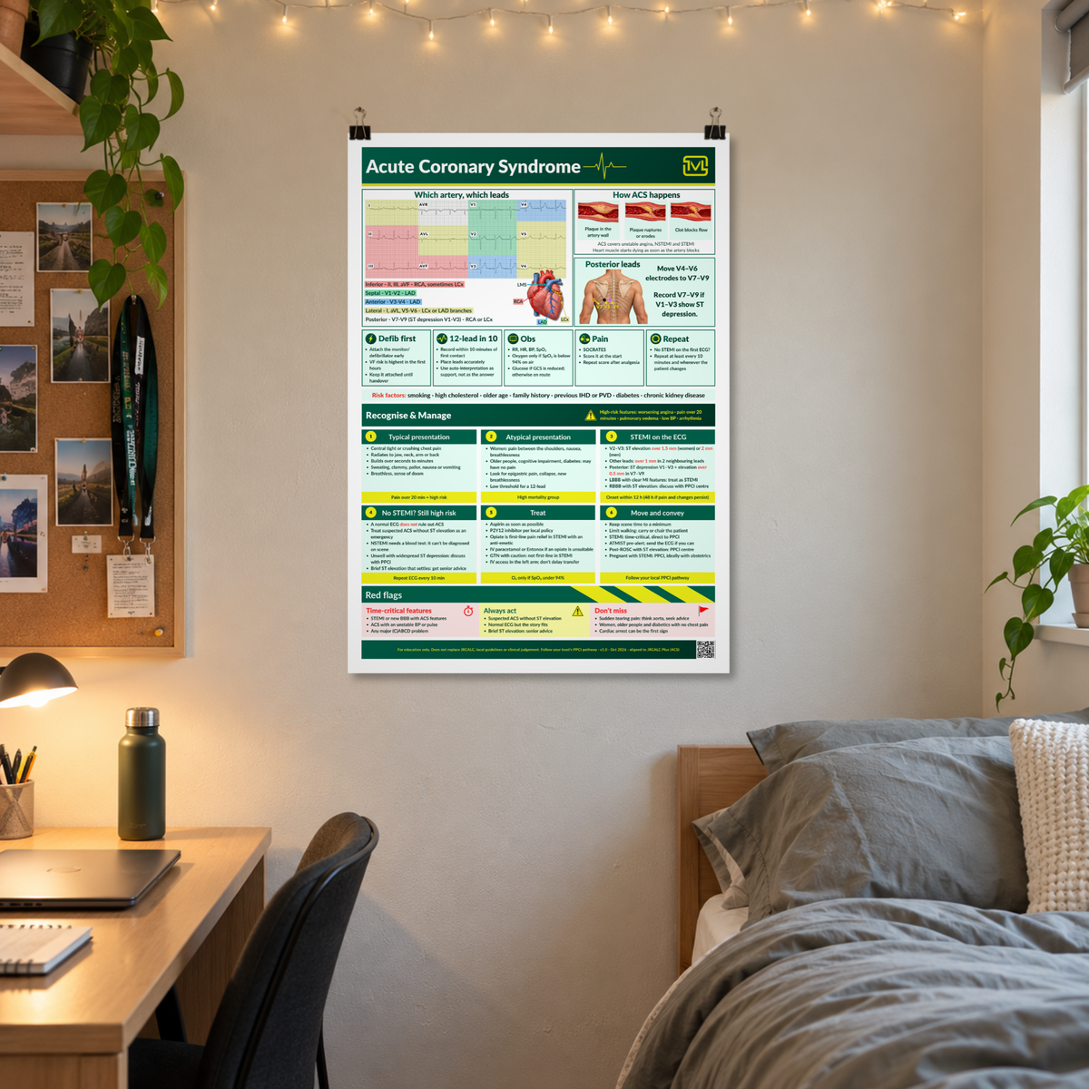 Acute Coronary Syndrome (ACS) ECG Poster