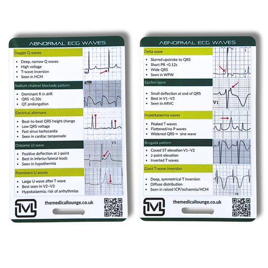 Abnormal ECG Waves Reference Card