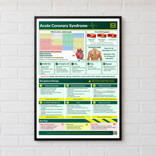 Acute Coronary Syndrome (ACS) ECG Poster