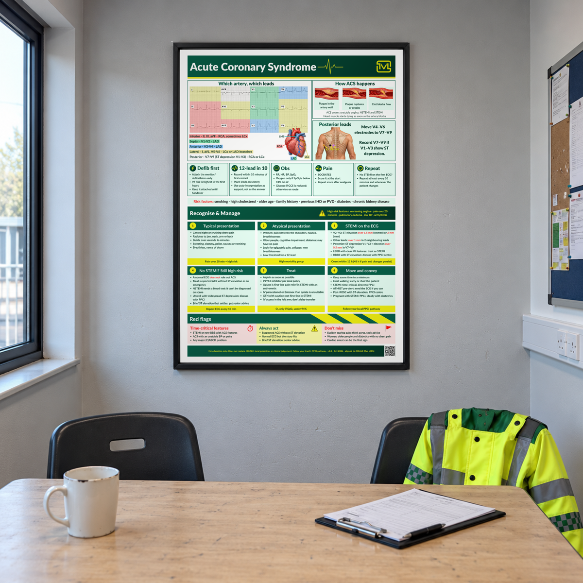 Acute Coronary Syndrome (ACS) ECG Poster