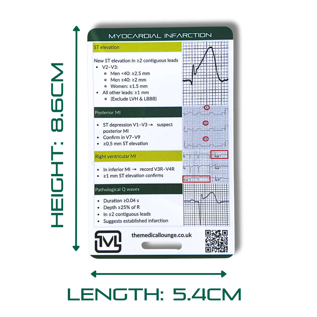 Myocardial Infarction (STEMI) ECG Reference Card