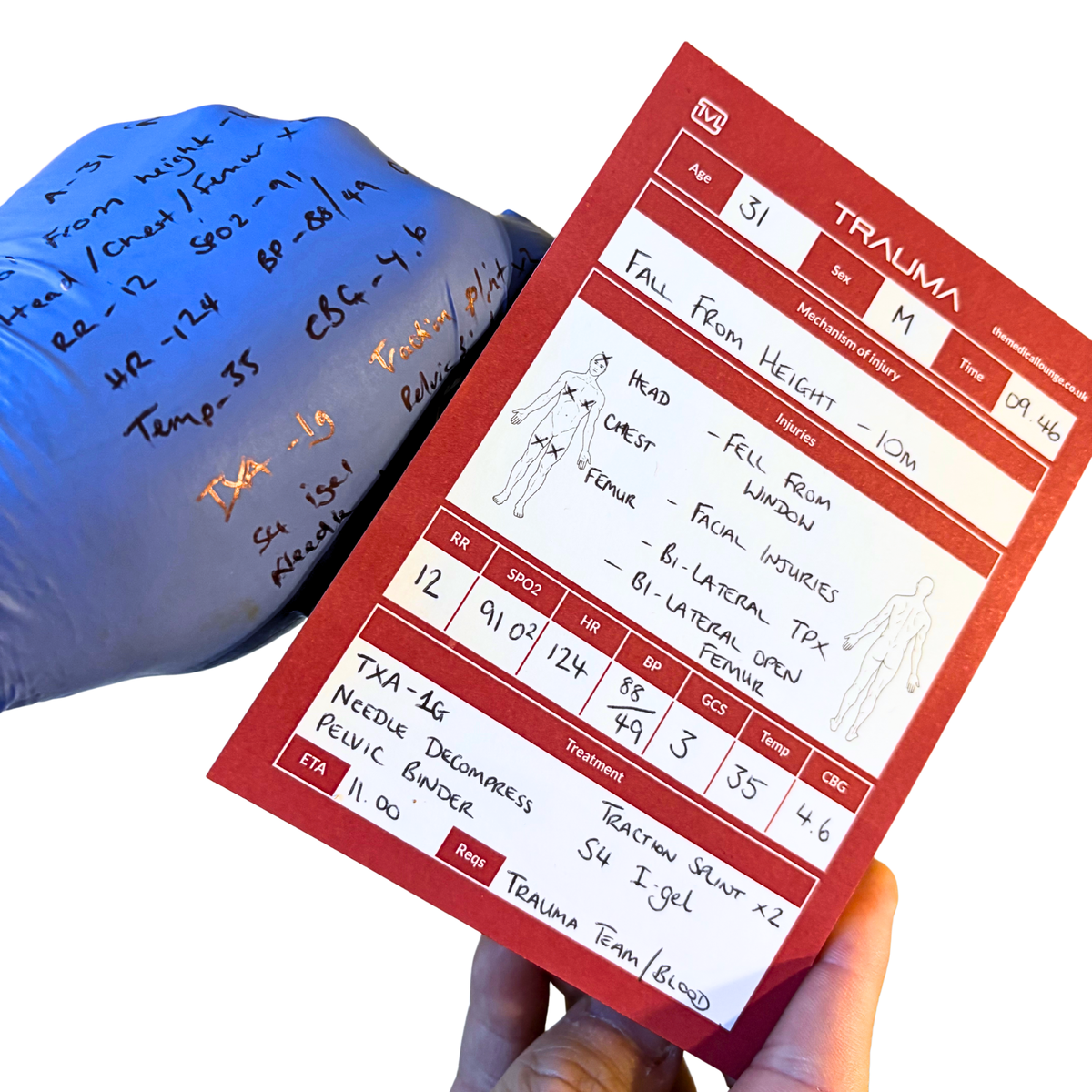 Paramedic Gift Set of 2 Handover Notepads | Trauma ATMIST & Medical SBAR Patient Report Pads | A6 Pocket Notebooks Student Paramedic EMT