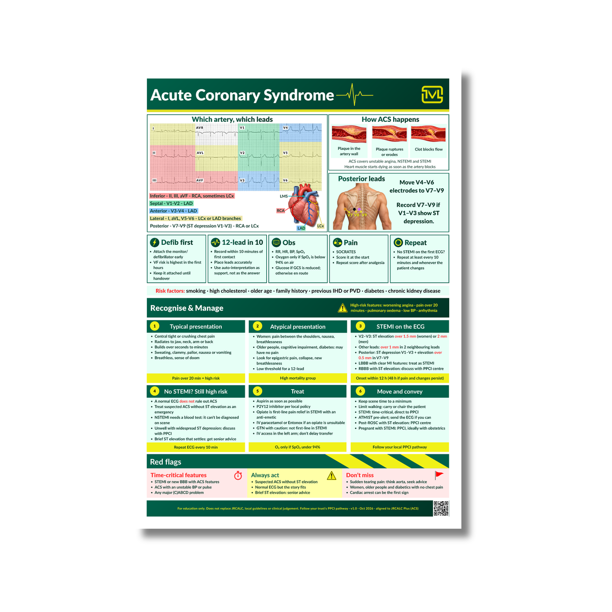 Acute Coronary Syndrome (ACS) ECG Poster