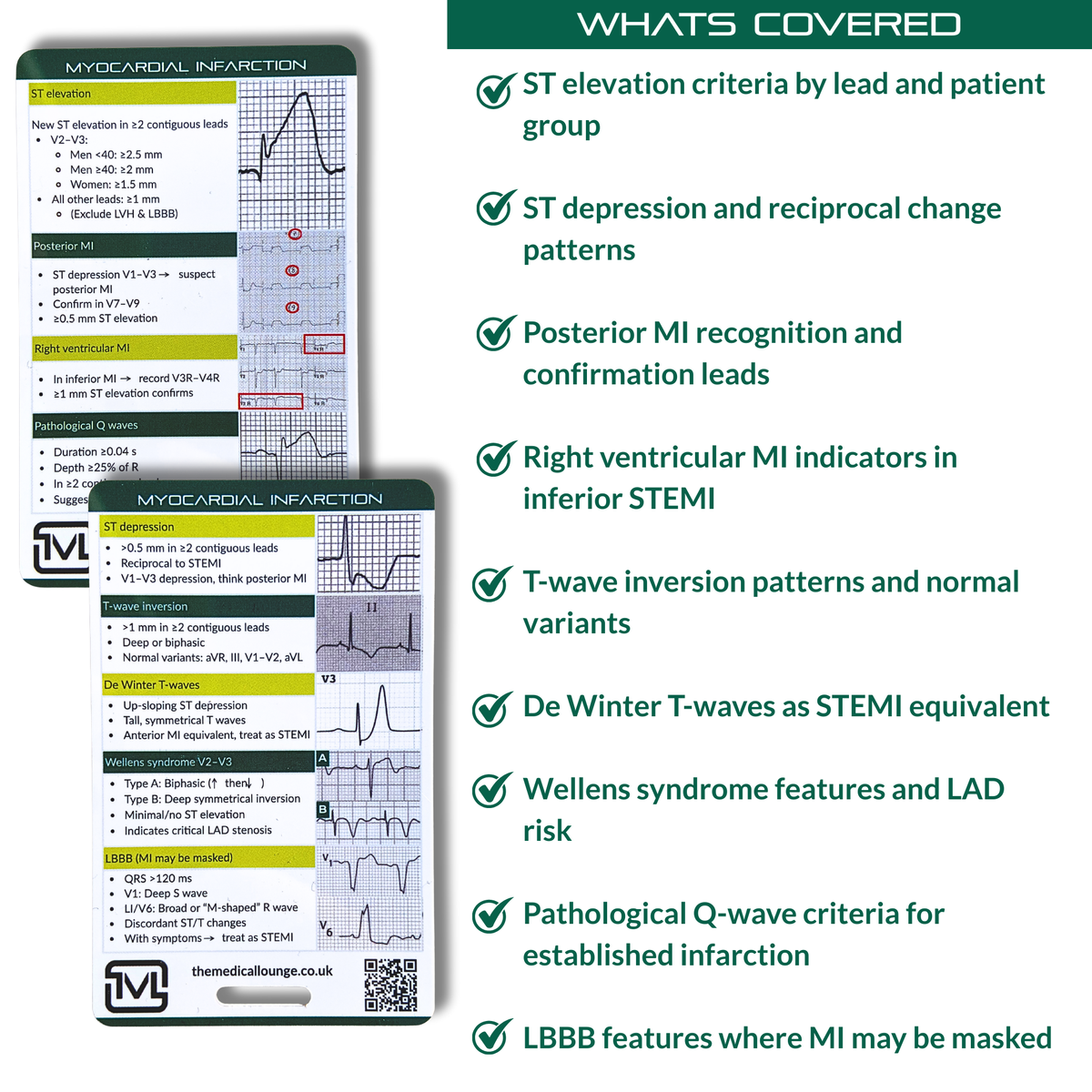 Myocardial Infarction (STEMI) ECG Reference Card