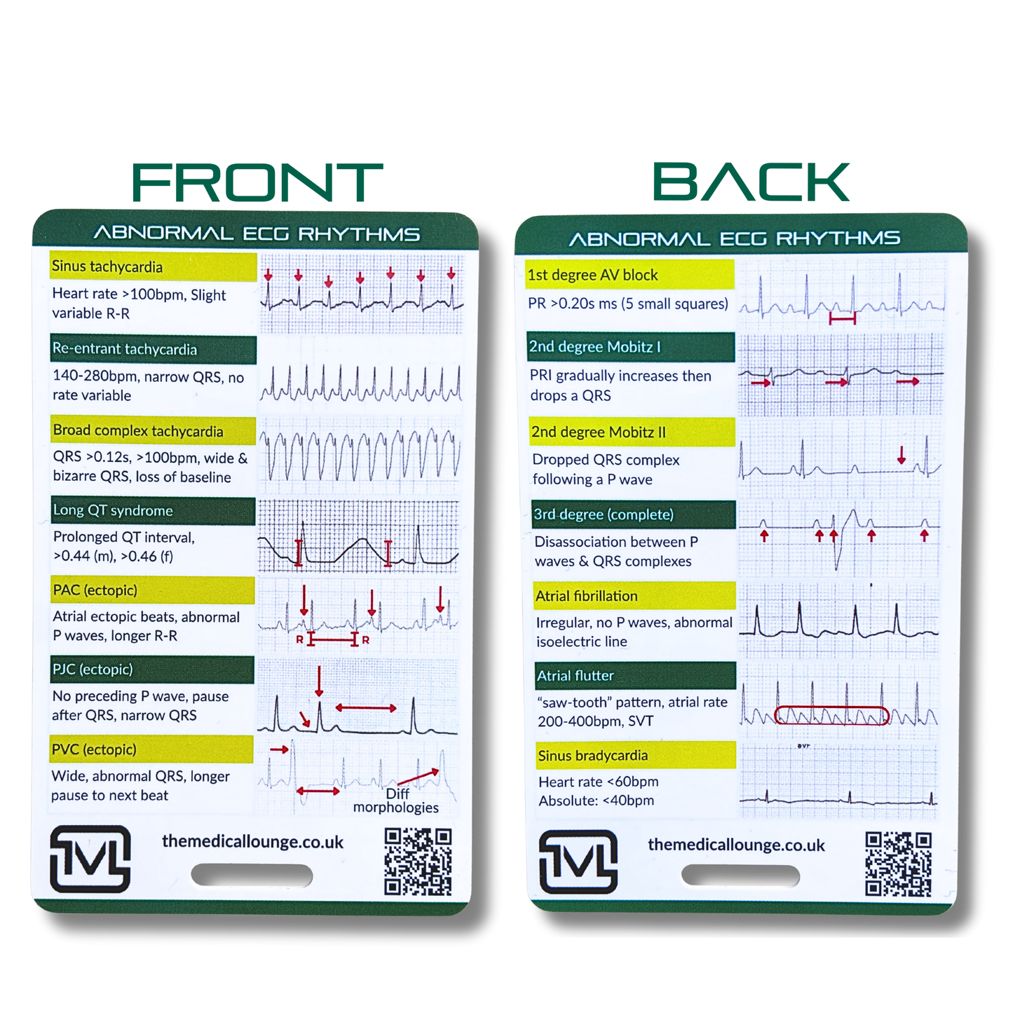Abnormal ECG Rhythms – Interpretation Card