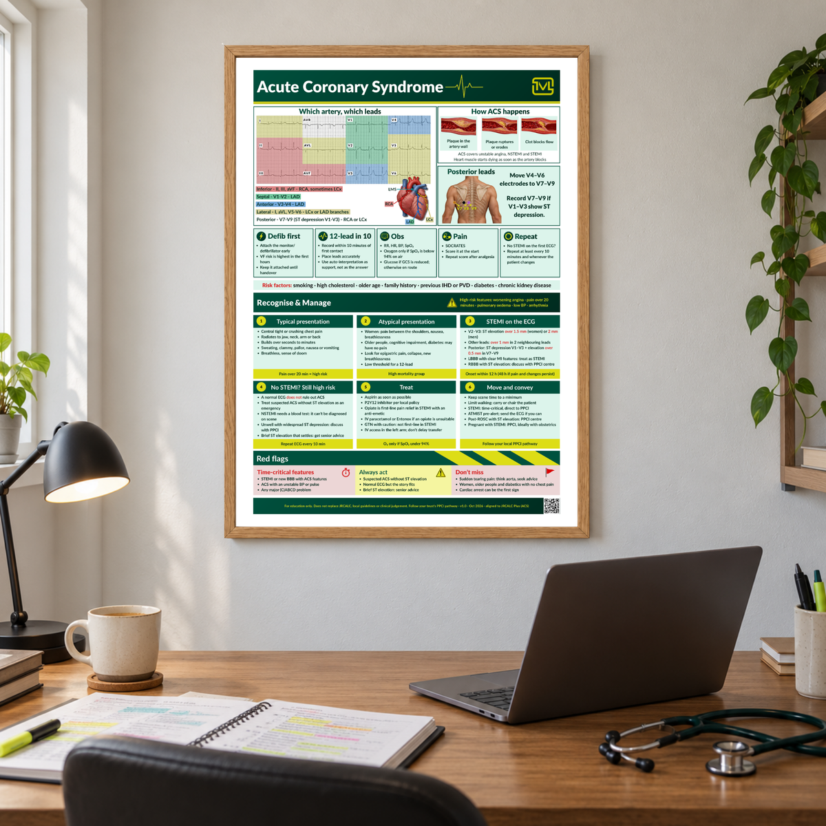 Acute Coronary Syndrome (ACS) ECG Poster