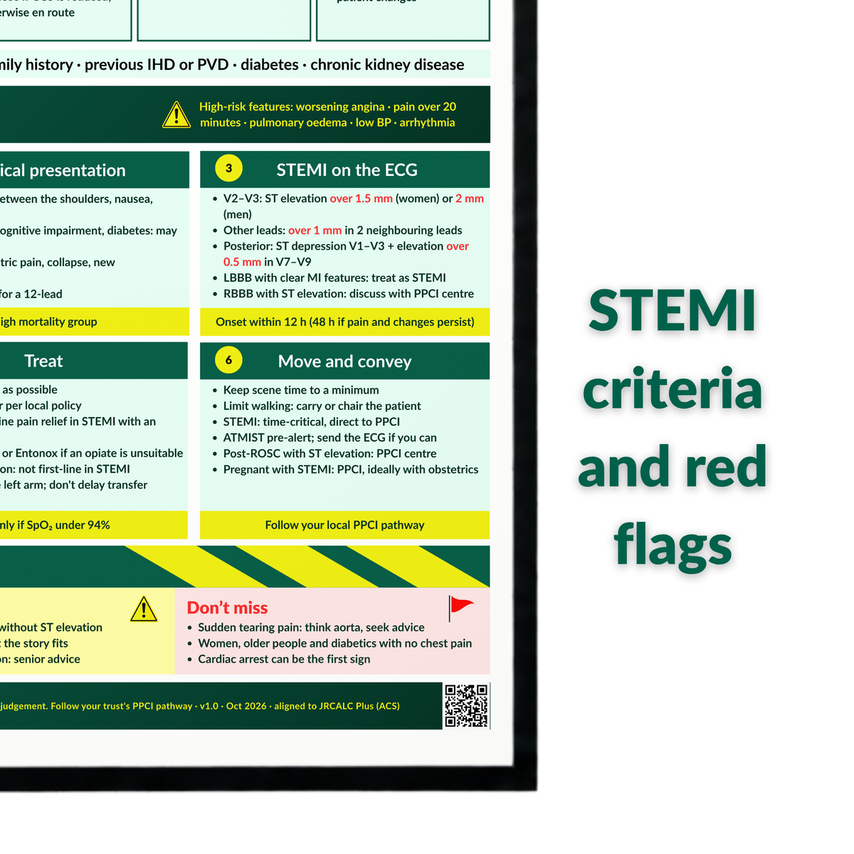 Acute Coronary Syndrome (ACS) ECG Poster