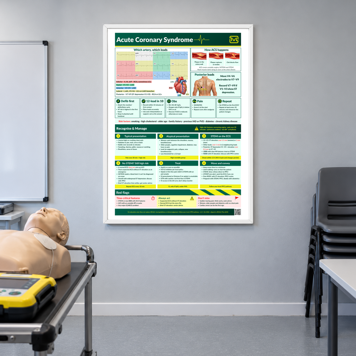 Acute Coronary Syndrome (ACS) ECG Poster